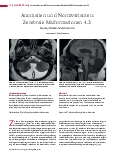 Vorschauseite 1: Anomalien und Normvarianten: Zerebrale Malformationen 4.3 Dandy-Walker-Malformation