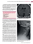 Vorschauseite 2: Anomalien und Normvarianten: Zerebrale Malformationen 4.3 Dandy-Walker-Malformation