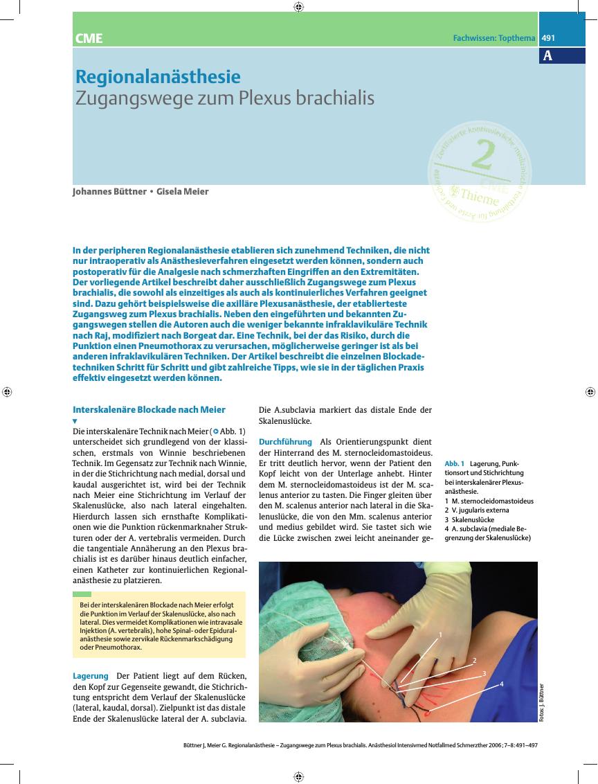 Vorschauseite 1: Regionalanästhesie - Zugangswege zum Plexus brachialis