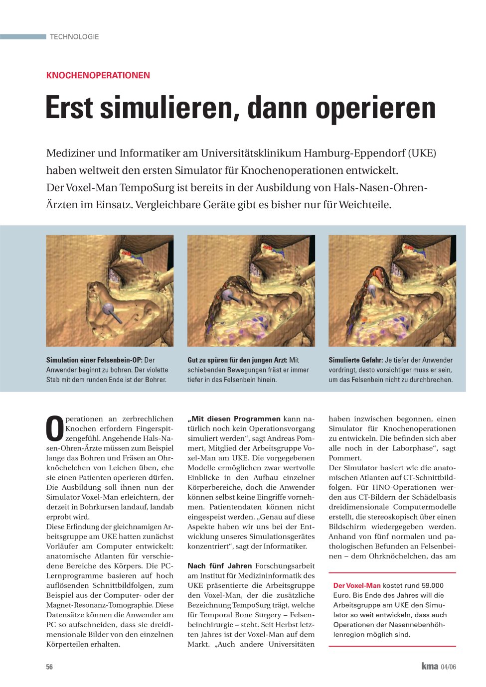 Vorschauseite 1: Erst simulieren, dann operieren