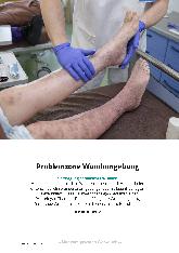 Vorschauseite 1: Problemzone Wundumgebung