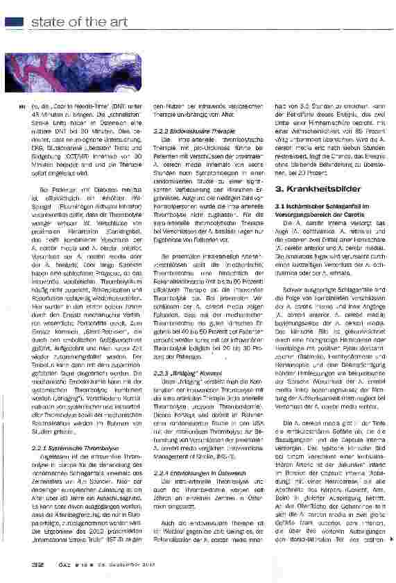 Vorschauseite 3: Ischämischer Schlaganfall