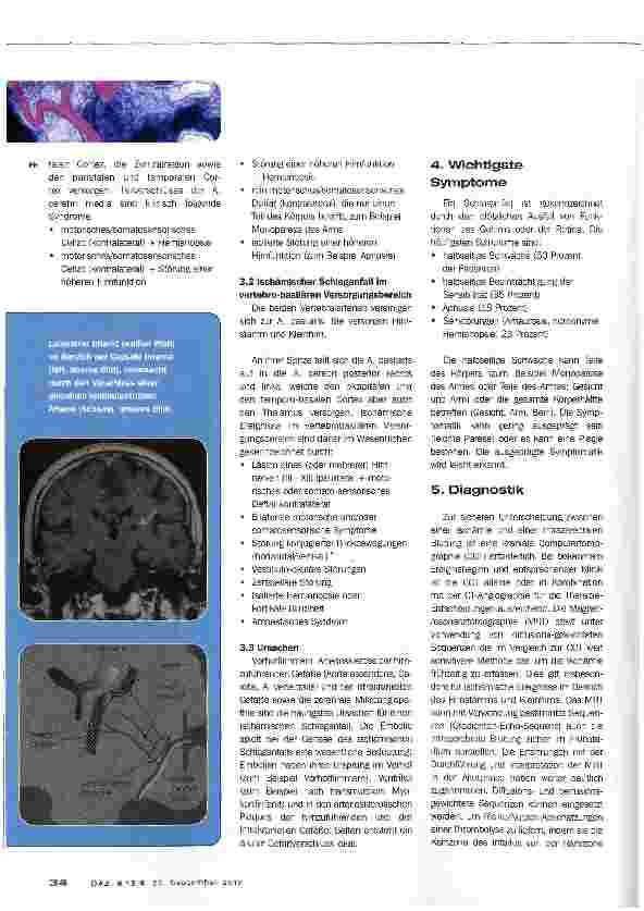Vorschauseite 4: Ischämischer Schlaganfall