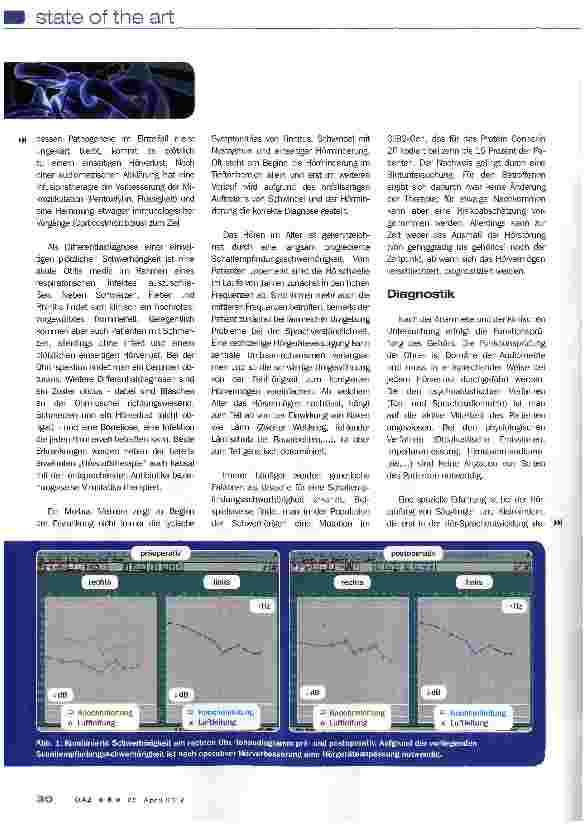 Vorschauseite 4: Schwerhörigkeit