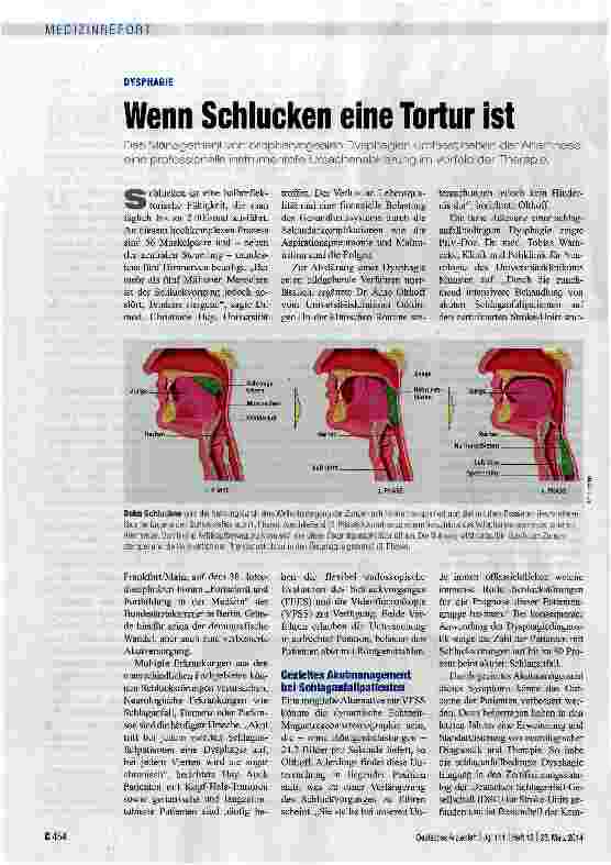 Vorschauseite 1: Wenn Schlucken eine Tortur ist