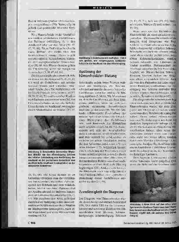 Vorschauseite 2: Was sind Hämorrhoiden? Sammelbegriff, Symptom oder Erkrankung?