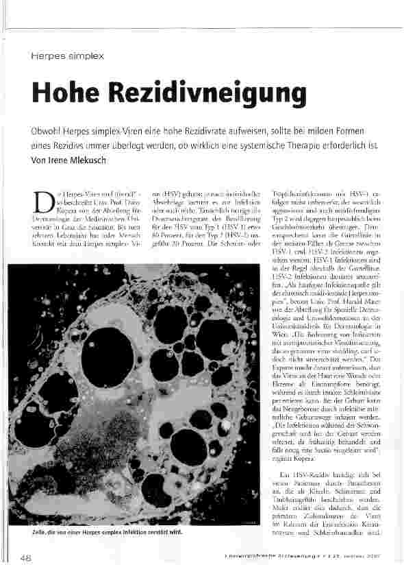 Vorschauseite 1: Herpes simplex - Hohe Rezidivneigung