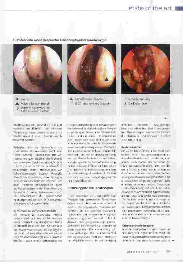 Vorschauseite 5: Behinderte Nasenatmung und Rhinosinusitis