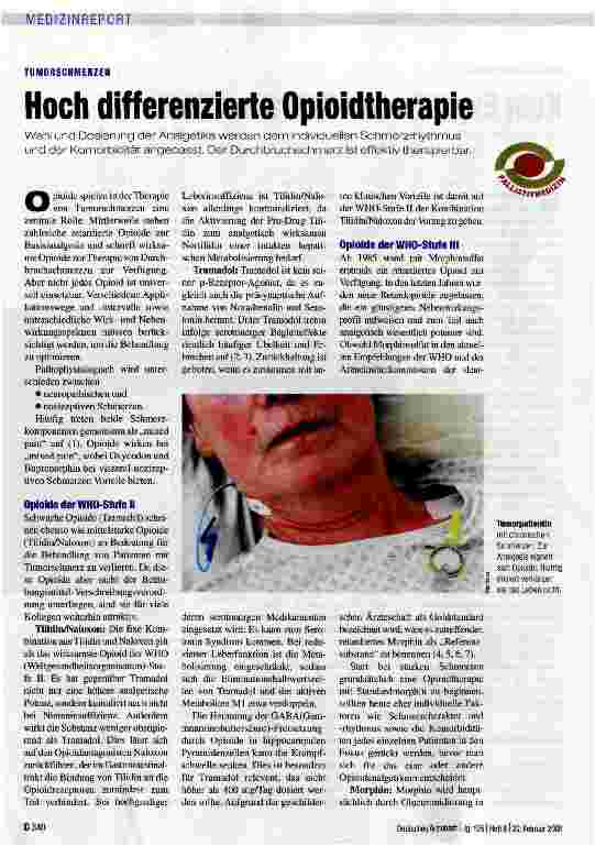 Vorschauseite 1: Hoch differenzierte Opioidtherapie