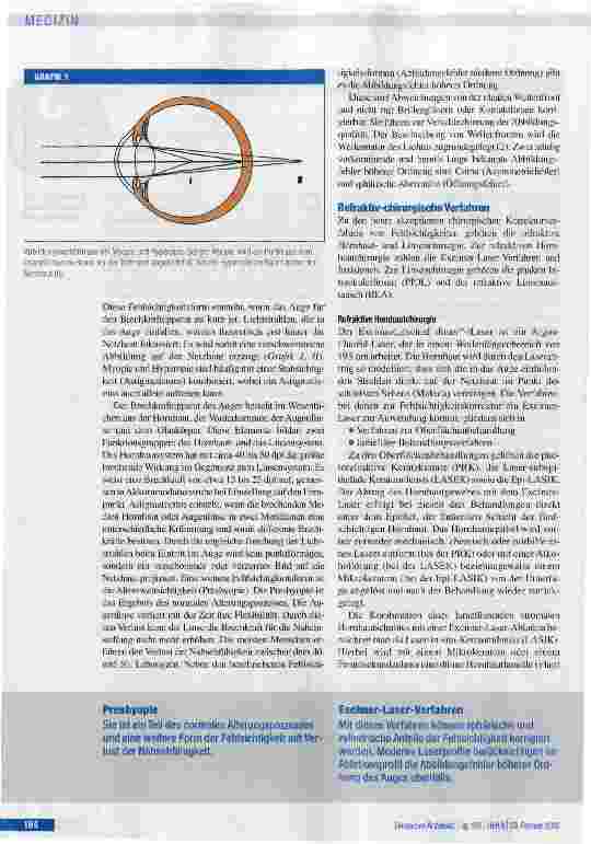 Vorschauseite 2: Basiswissen refraktive Chirurgie