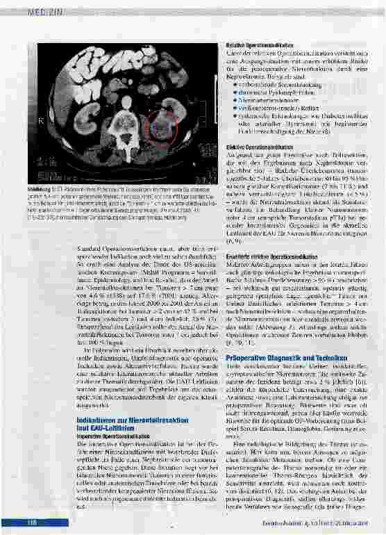 Vorschauseite 2: Wichtige Aspekte der organerhaltenden Nierentumorchirurgie