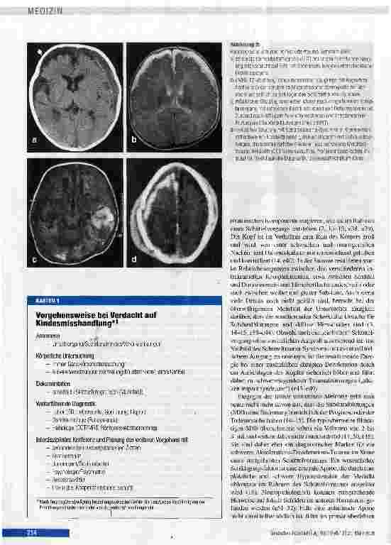 Vorschauseite 4: Das Schütteltrauma-Syndrom