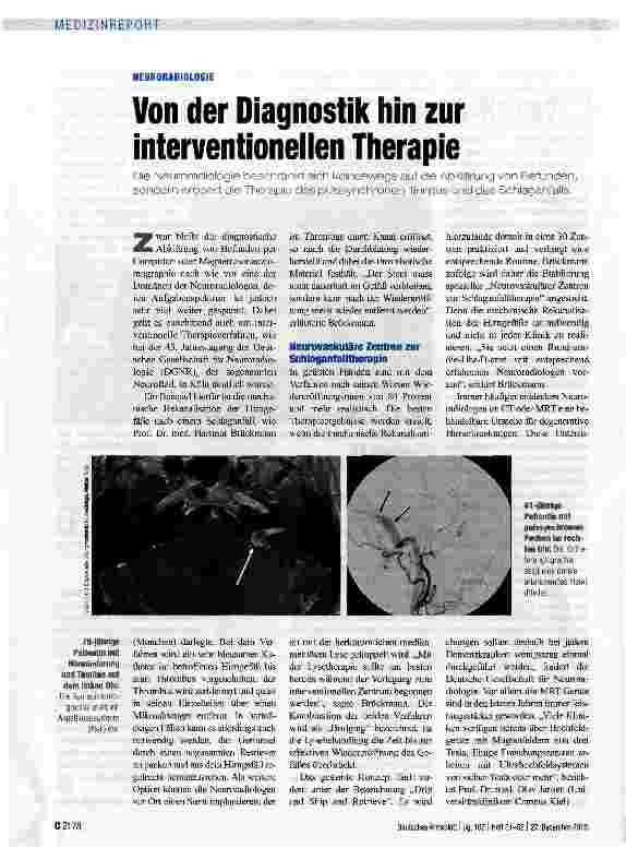 Vorschauseite 1: NEURORADIOLOGIEVon der Diagnostik hin zur interventioneilen Therapie