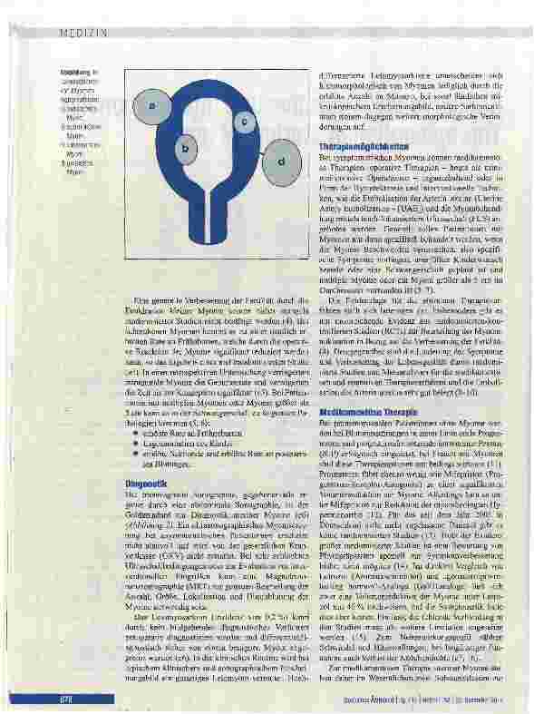 Vorschauseite 2: Konservative, operative und interventioneile Therapieoptionen uteriner Myome