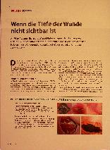 Vorschauseite 1: Wenn die Tiefe der Wunde nicht sichtbar ist.