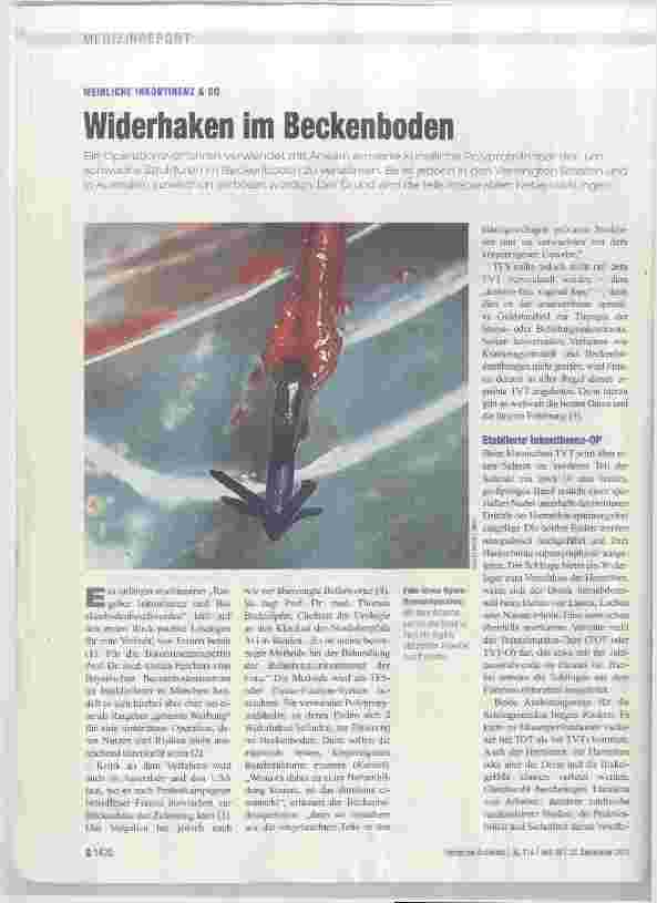 Vorschauseite 1: Widerhaken im Beckenboden
