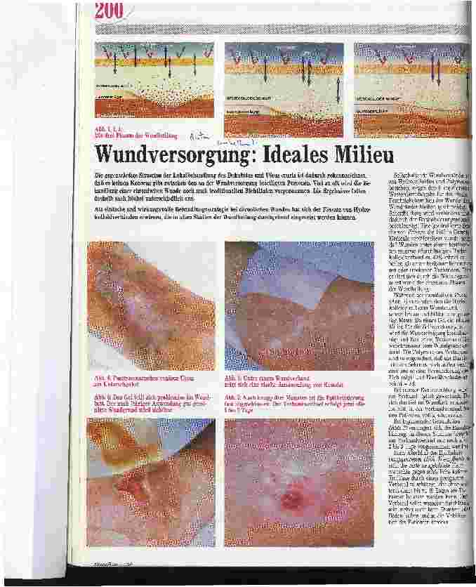 Vorschauseite 1: Wundversorgung: Ideales Milieu