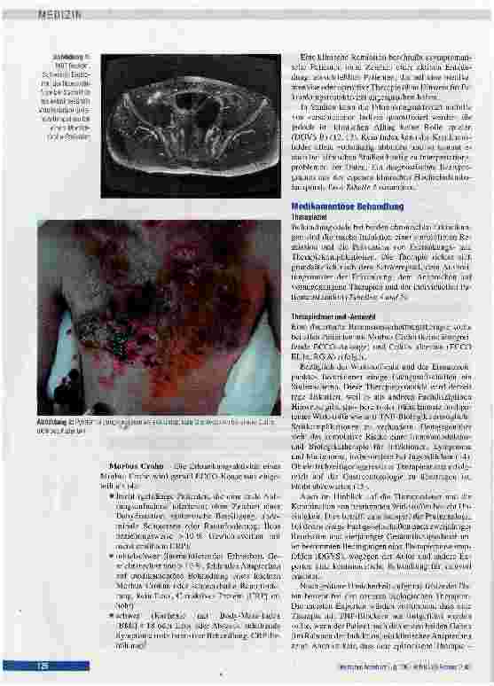 Vorschauseite 4: Diagnostik und Therapie von Morbus Crohn und Colitis ulcerosa