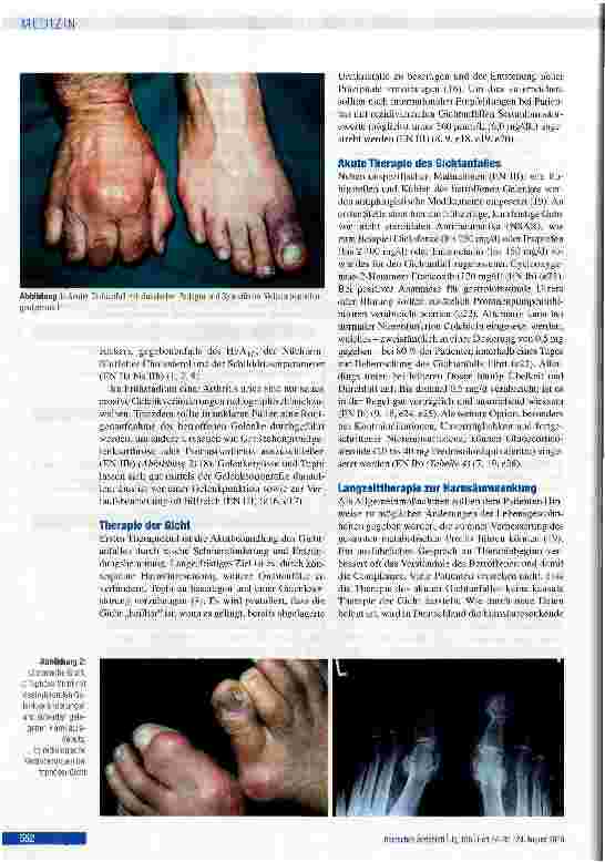 Vorschauseite 4: Gicht - aktuelle Aspekte in Diagnostik und Therapie