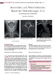 Vorschauseite 1: Anomalien und Normvarianten: Skelettale Veränderungen 3.16 Stummelrippen der Wirbelsäule