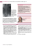 Vorschauseite 3: Anomalien und Normvarianten: Skelettale Veränderungen 3.16 Stummelrippen der Wirbelsäule