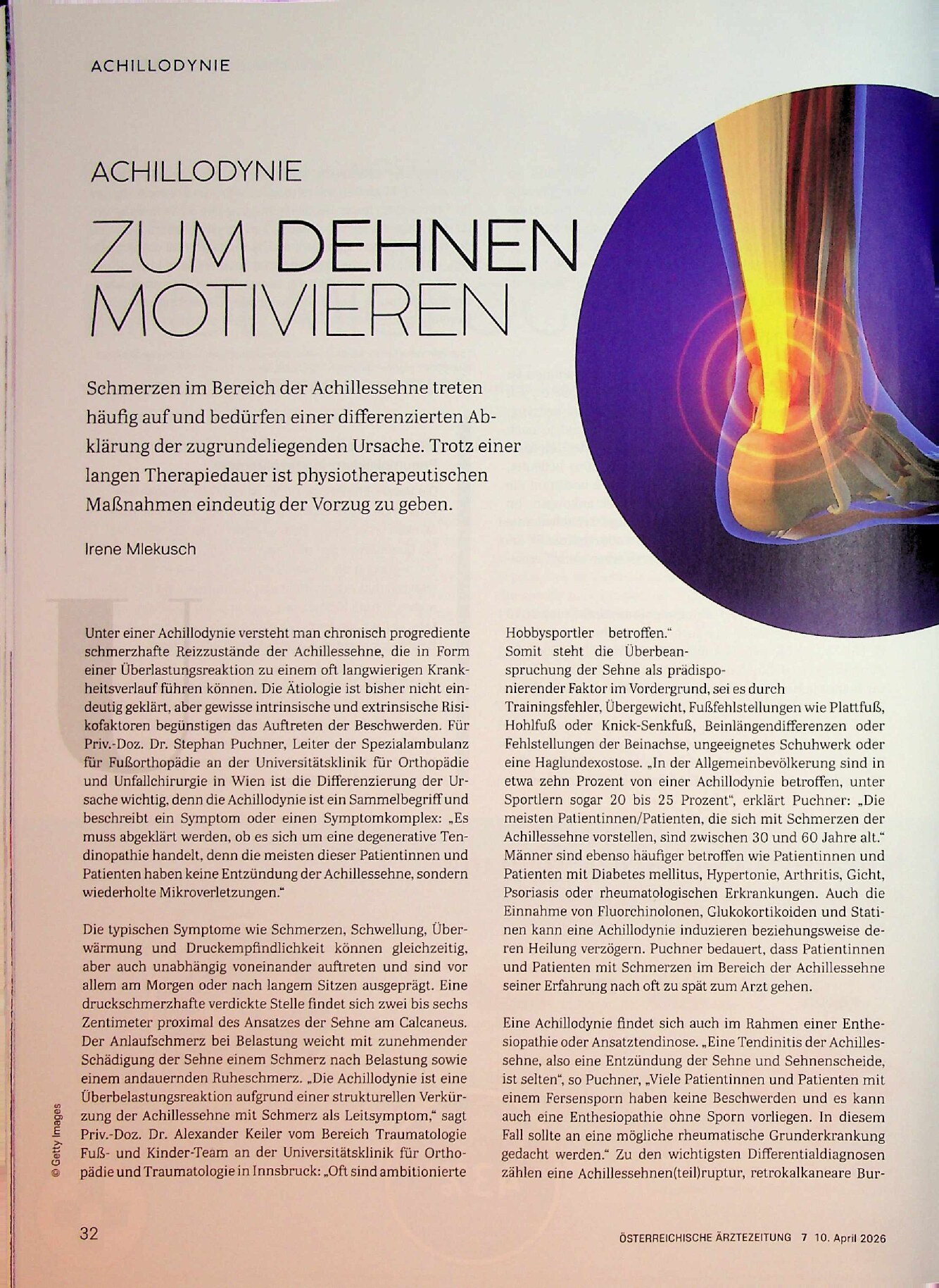 Vorschauseite 1: Achillodynie – Zum Dehnen motivieren