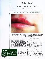 Vorschauseite 1: Dicke Lippe? Herpes labialis naturheilkundlich behandeln
