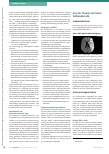 Vorschauseite 3: Erfassung multimodaler Kommunikation bei Aphasie: Möglichkeiten der klinischen Anwendung des Szenario-Tests