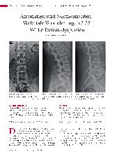 Vorschauseite 1: Anomalien und Normvarianten - Skelettale Veränderungen 3. 35: Wirbelfortsatzdysplasien