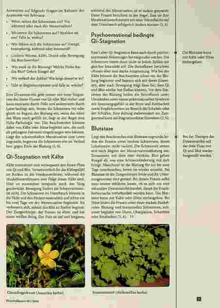 Vorschauseite 3: TCM mit westlichen Kräutern bei Dysmenorrhöse