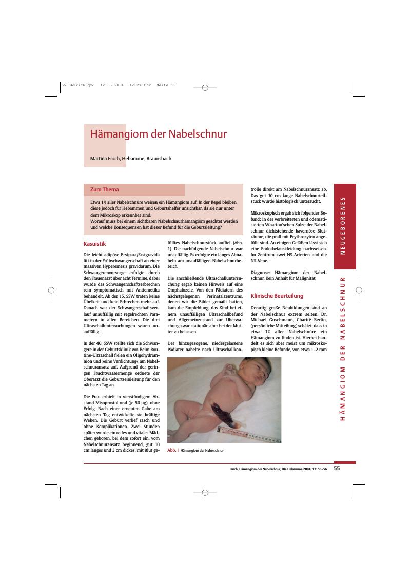 Vorschauseite 1: Hämangiom der Nabelschnur