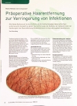 Vorschauseite 1: Präoperative Haarentfernung zur Verringerung von Infektionen