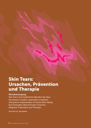 Vorschauseite 1: Skin Tears: Ursachen, Prävention und Therapie