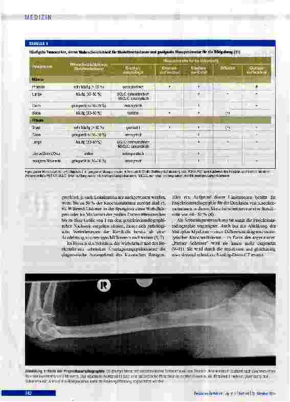 Vorschauseite 2: Bildgebende Diagnostik von Knochenmetastasen