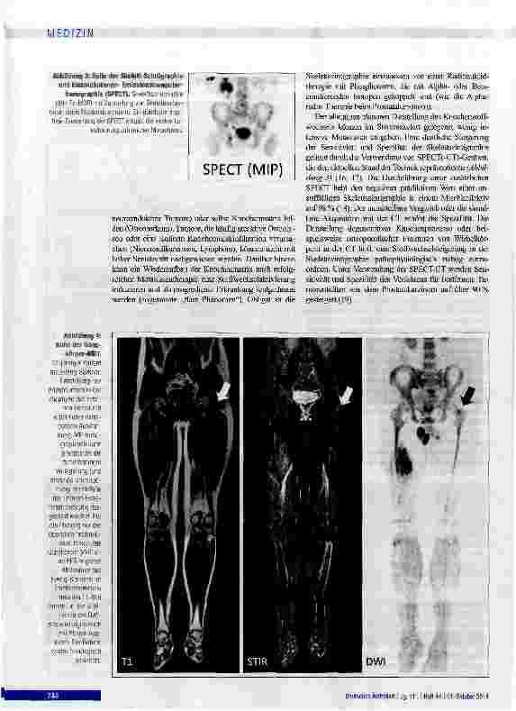 Vorschauseite 4: Bildgebende Diagnostik von Knochenmetastasen