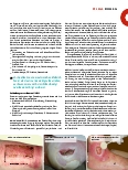 Vorschauseite 2: MARSI – wenn Verbandmittel kleben