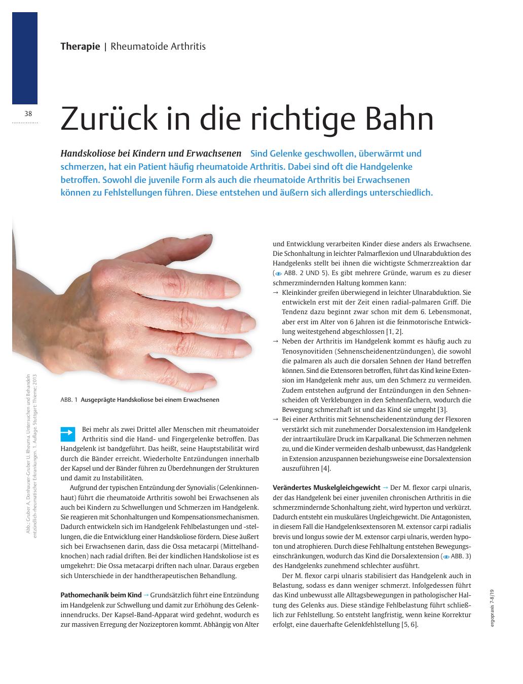 Vorschauseite 1: Zurück in die richtige Bahn? Handskoliose bei Kindern und Erwachsenen