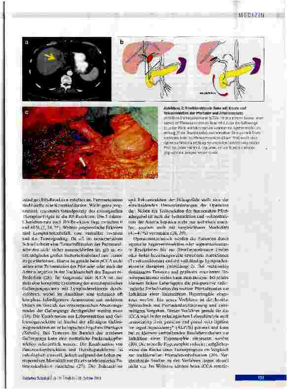 Vorschauseite 4: Diagnostik und Therapie von Cholangiokarzinomen