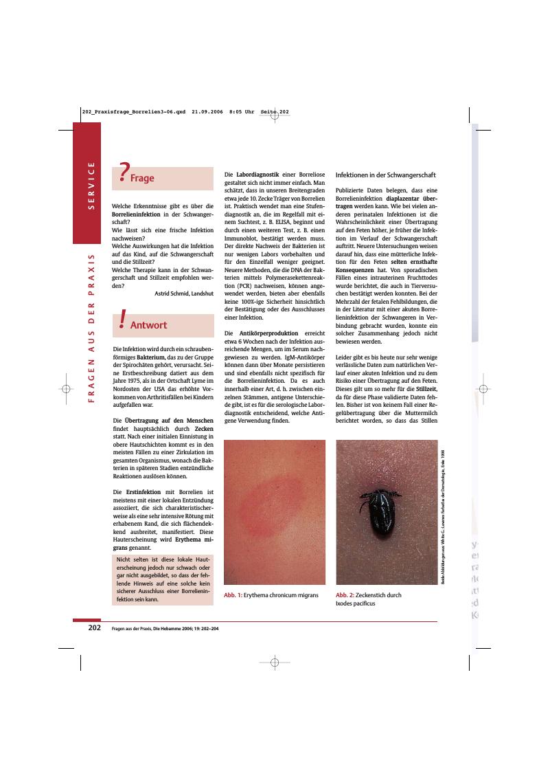 Vorschauseite 1: Borrelieninfektion in der Schwangerschaft
