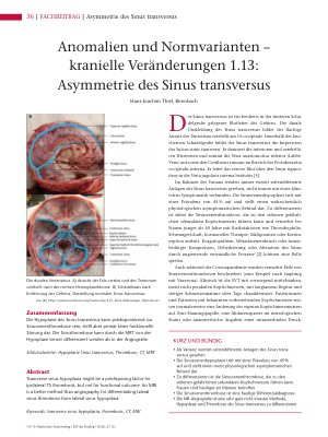 Vorschauseite 1: Anomalien und Normvarianten – kranielle Veränderungen 1. 13: Asymmetrie des Sinus transversus