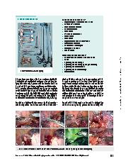 Vorschauseite 4: Abdominothorakale Ösophagusresektion mit da Vinci