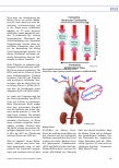 Vorschauseite 6: Mechanische Kreislaufunterstützung via ECMO