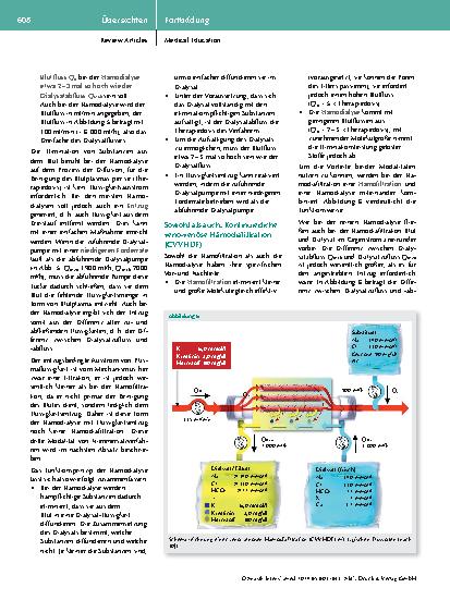 Vorschauseite 6: Kontinuierliche Nierenersatzverfahren in der Intensivmedizin