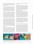 Vorschauseite 4: Operation nach Nuss - minimalinvasives Verfahren zur Korrektur der Trichterbrust
