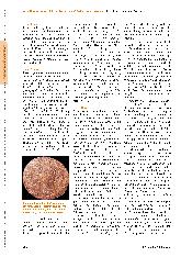 Vorschauseite 2: Kaiser Claudius und das Stottern - Erneuter E-Mail-Austausch unter Brüdern