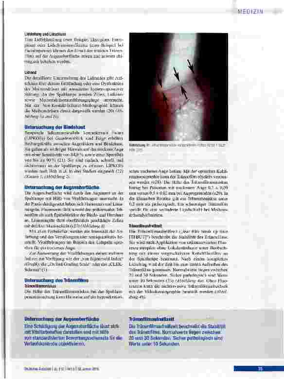 Vorschauseite 5: Pathophysiologie, Diagnostik und Therapie des trockenen Auges