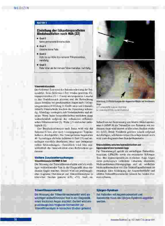 Vorschauseite 6: Pathophysiologie, Diagnostik und Therapie des trockenen Auges