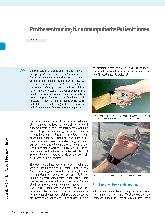 Vorschauseite 1: Prothesentraining für armamputierte Patient*innen
