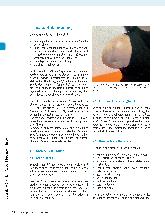 Vorschauseite 3: Prothesentraining für armamputierte Patient*innen