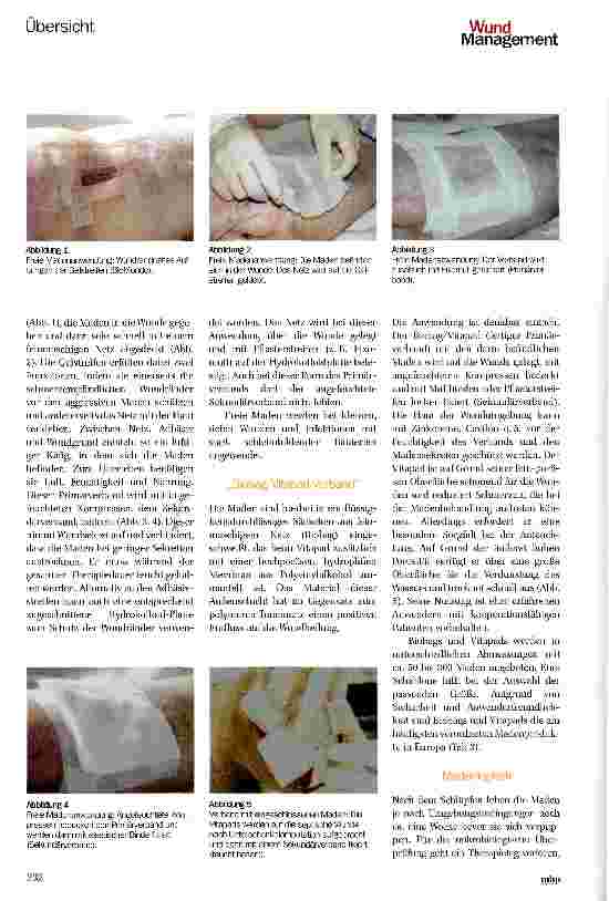 Vorschauseite 3: Biologisches Debridement